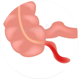 ULTRASONIDO APENDICULAR (APENDICE)