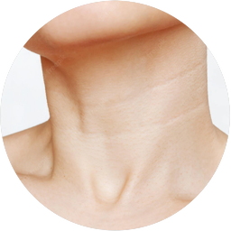 ULTRASONIDO DE CUELLO (PARTES BLANDAS)